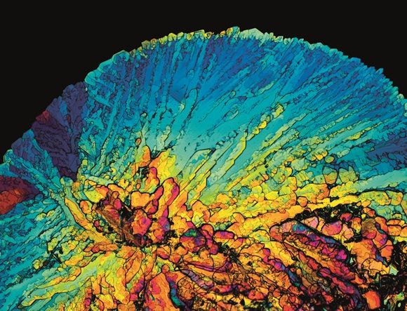 ML-Based Diabetes Mellitus Prediction